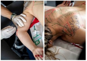 Curs dry needling MedBoost Academy – aplică acupunctura musculară în tratamentul durerii miofasciale